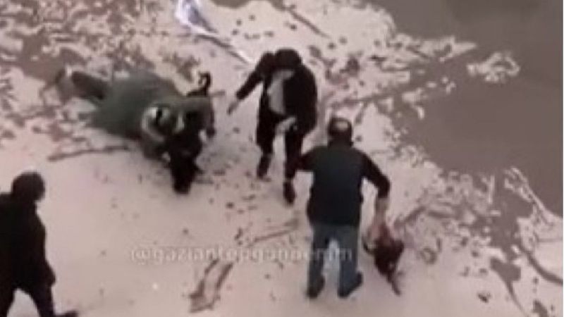 Pitbull saldırısına uğrayan Asiye'nin babası konuştu