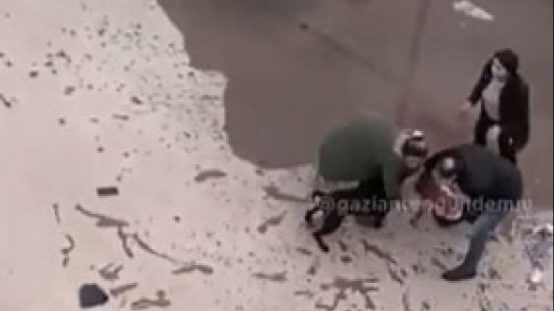 Gaziantep'te pitbullun ısırdığı Asiye'nin doktoru, bilgilendirme yaptı