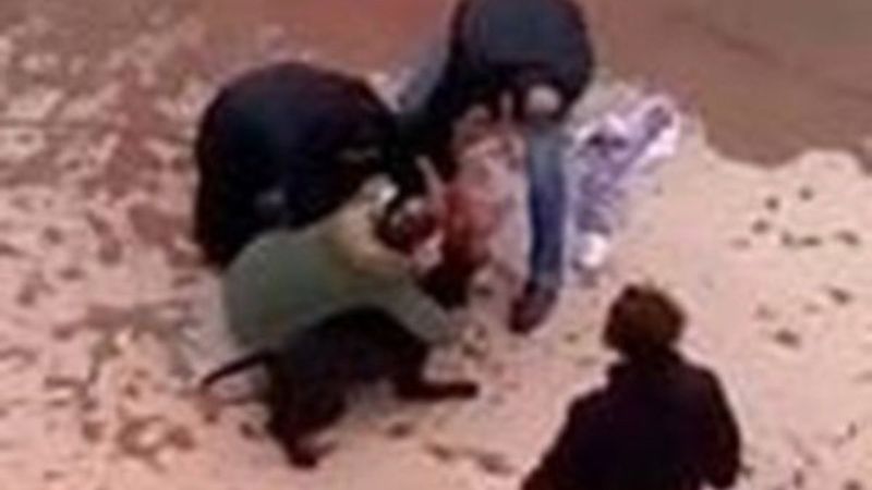 Gaziantep'te pitbull saldırısına uğrayan Asiye'nin doktoru konuştu