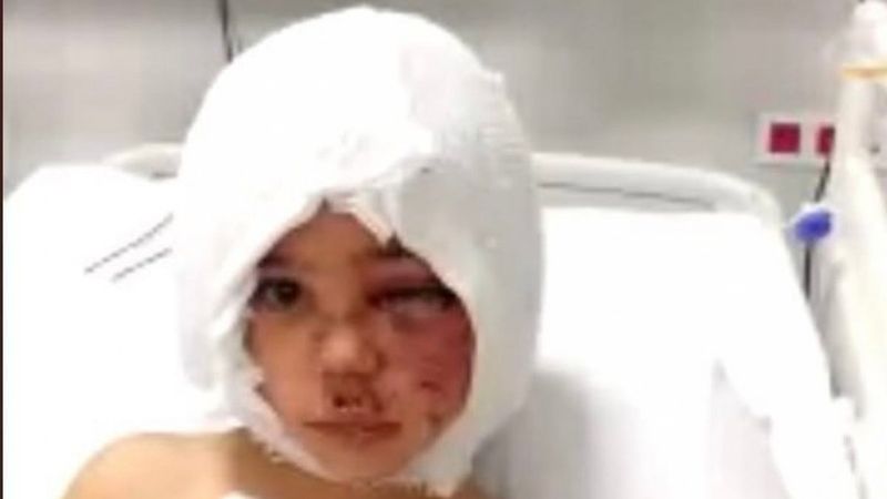 Gaziantep'teki pitbull saldırısına ilişkin görüntülerin bir kısmının silindiği belirlendi