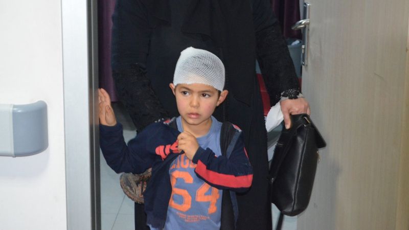 Aksaray'da 6 yaşındaki Fevvaz, köpeğin saldırısıyla yaralandı