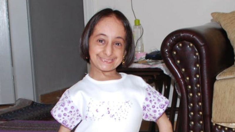 Türkiye'nin en kısa boylu kadını öldü