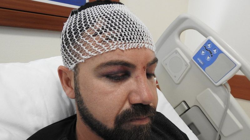 Gaziantep'te 15 kişinin saldırdığı genç beyin kanaması geçirdi