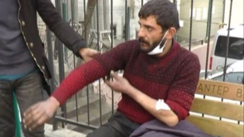 Gaziantep'te ikinci pitbull vakası