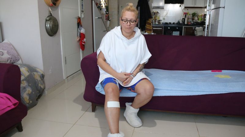 Antalya’da sokak köpeği tarafından ısırılan aşçı kadın kabusu yaşadı