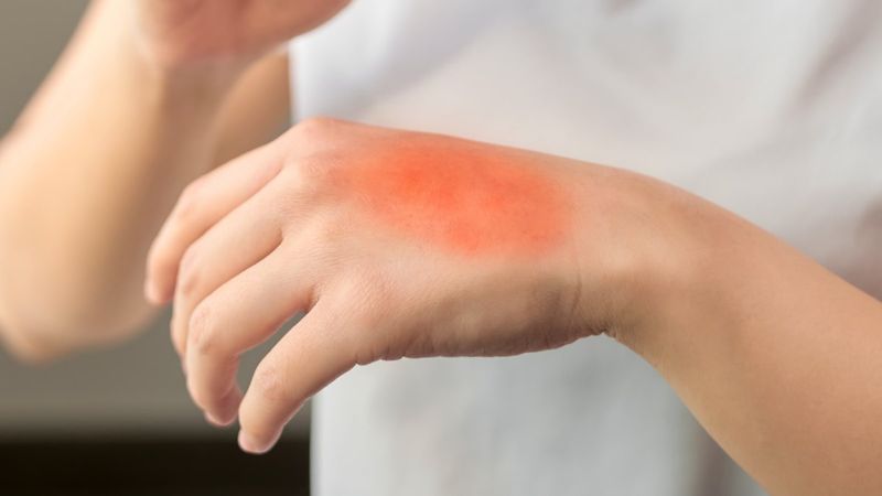 Omicron belirtileri ciltte de ortaya çıkıyor