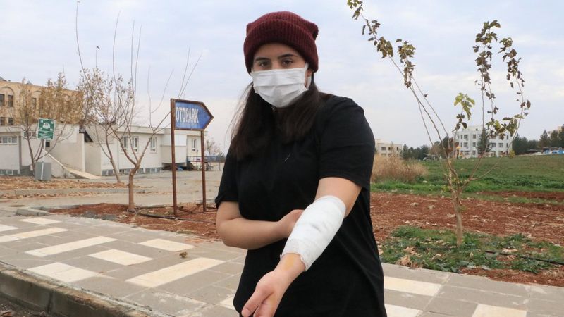 Şanlıurfa'daki üniversite kampüsünde köpek dehşeti