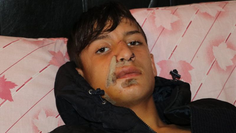 Adana'da 16 yaşındaki genç, tırın altında kaldı