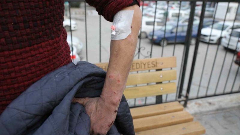 Gaziantep'te pitbull saldırısı: 2 gözaltı