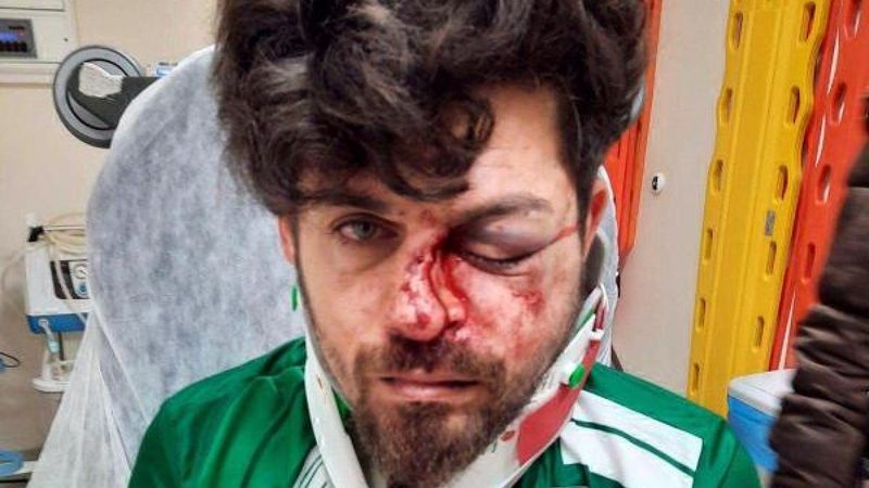 Kırmızı kart gören futbolcu, rakibinin yüzüne tekme atıp yaraladı