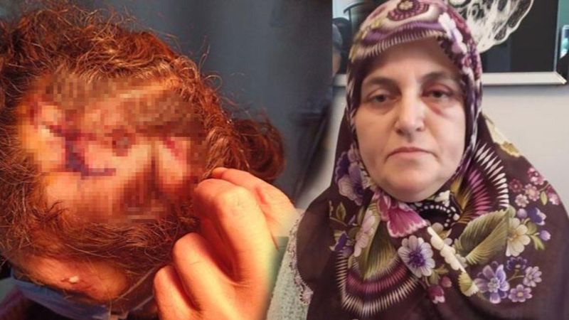 İstanbul'da komşusuna çekiçle saldıran kişi serbest bırakıldı