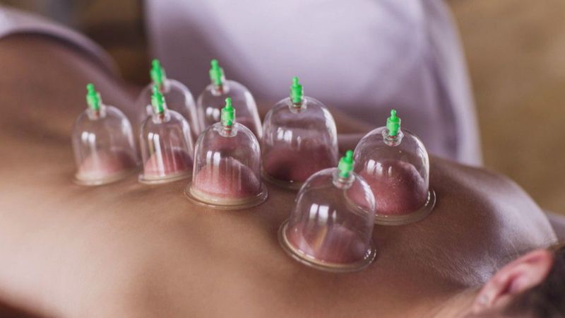 Hacamat günleri 2022: Bu yıl hacamat hangi günler yapılmalı