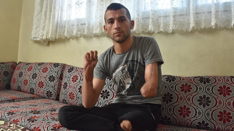 Adanalı genç, protez desteği bekliyor