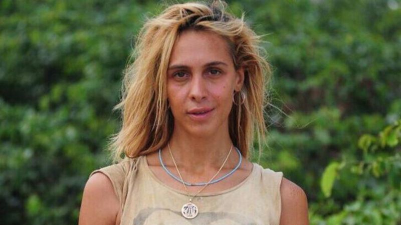 Estetikle evrim geçirdi! Survivor Duygu Bal, artık bambaşka biri...