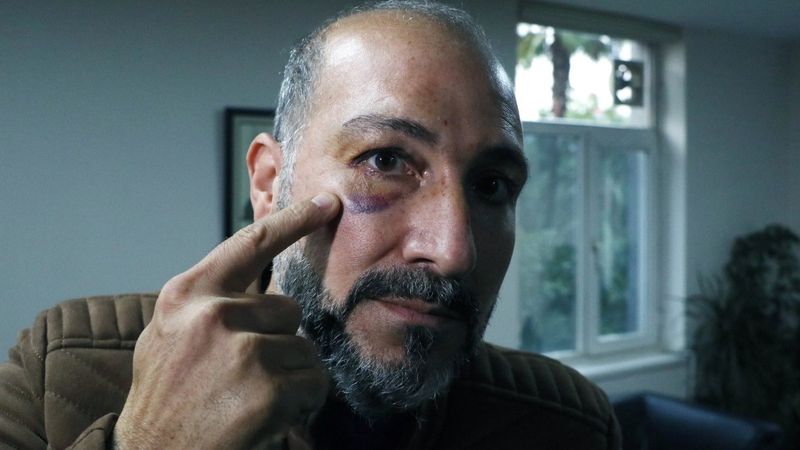 Adana’da veteriner hekime darp şüphelisi: İlk o vurdu