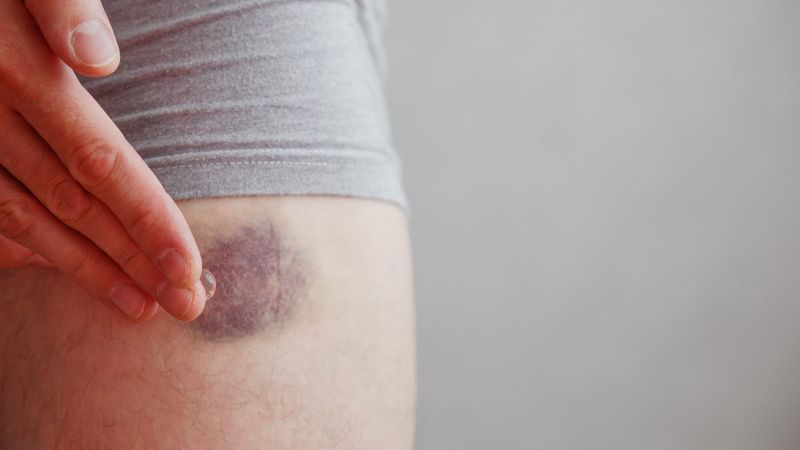 C vitamini eksikliğini gösteren 9 önemli işaret