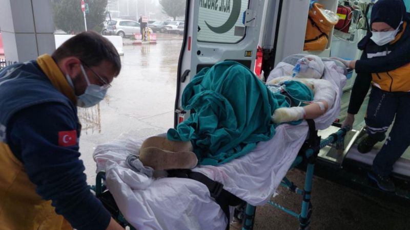 Ordu'da cani adam eski eşini yaktı