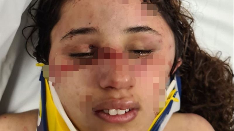 Adana'da 7 aylık hamile kadın, eşinin işkencesine maruz kaldı