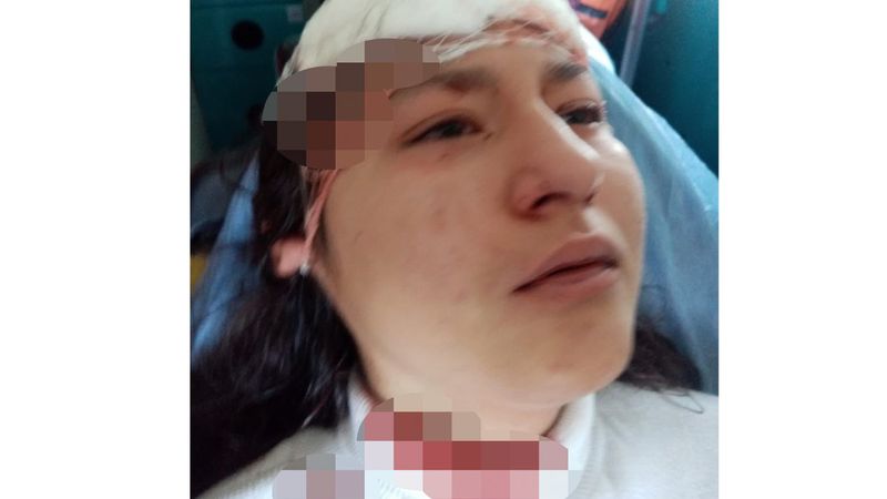 Kastamonu'da fotoğraf çeken genç kız 5 köpeğin saldırısına uğradı