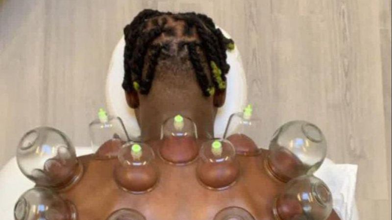 Michy Batshuayi hacamat yaptırdı