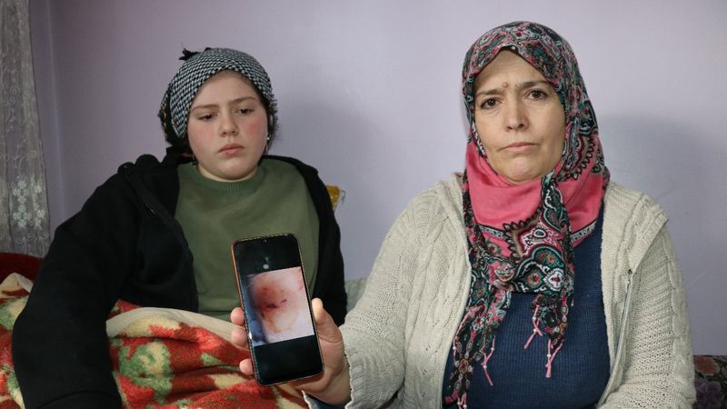 Van'da köpek dehşeti: Genç kızın bacağı parçalandı