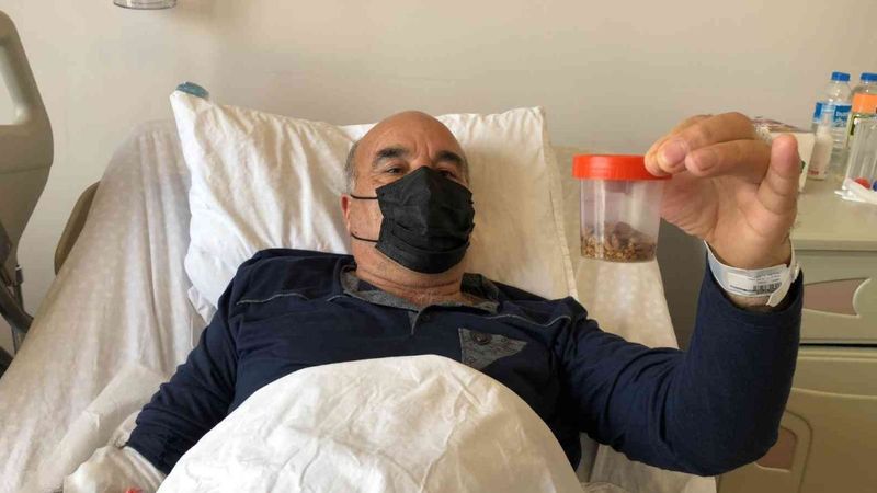 Sakarya’da, böbreğinden 1.200 taş çıkarıldı