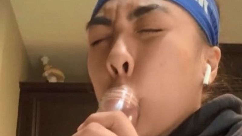 Gençler için tehlike çanları çalıyor: Evde estetik akımına uyarı