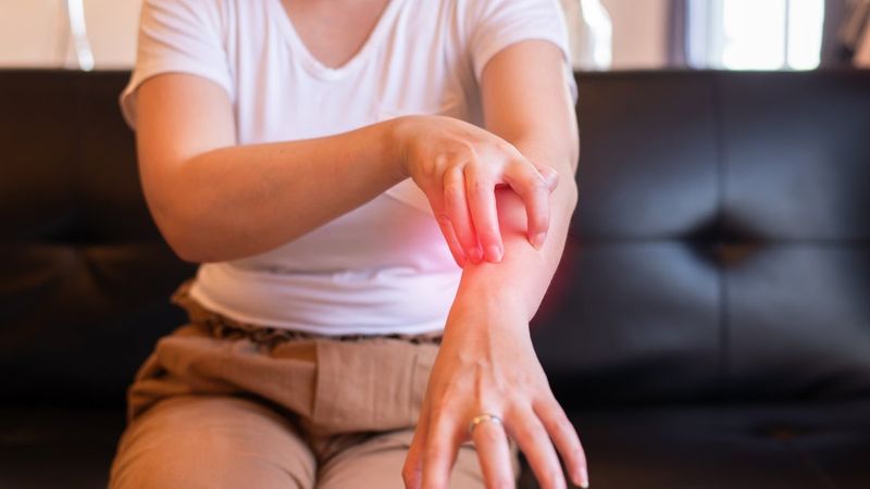 Egzama nedir ve nasıl tedavi edilir