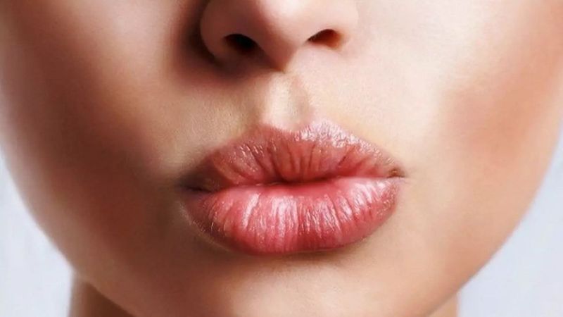 Dudak üstündeki gizemli çukur: Filtrum