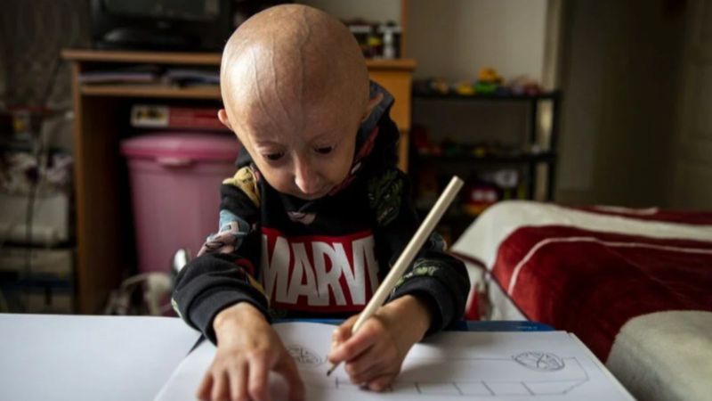 9 yaşındaki Veysel'in hayat mücadelesi