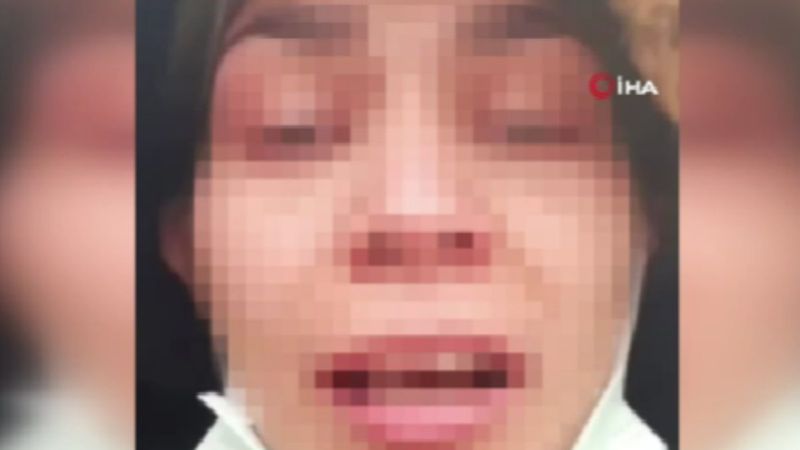 Sakarya'da eski eş mağduru: Ölmek istemiyorum