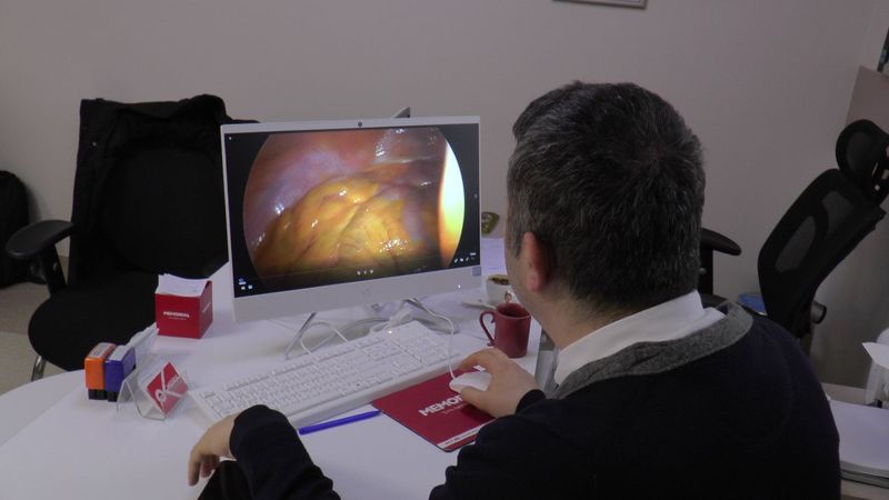 Daha az ağrıyla ameliyat olma yöntemi: Laparoskopik cerrahi