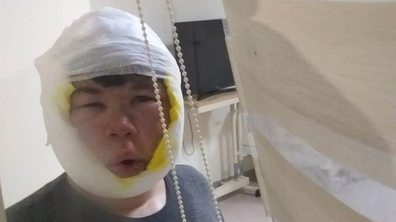 Gaziantep'te bomba gibi patlayan teneke ölümden döndürdü