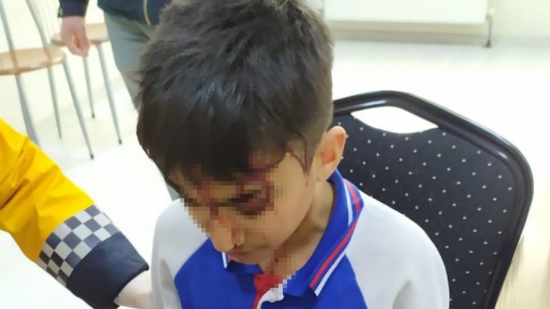 Isparta'da okul dönüşü köpek saldırdı