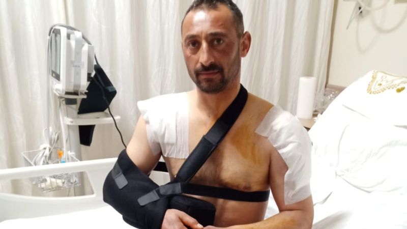 Tokat'ta domuz saldırısına uğradı