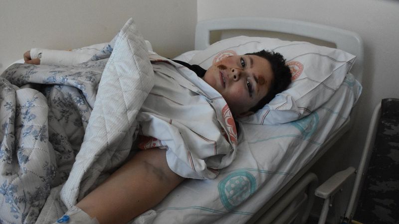 Sivas'ta köpekten kaçarken otomobilin çarptığı çocuk, hayati tehlikeyi atlattı