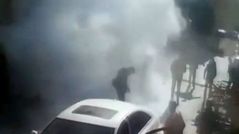 Kastamonu’da sobadan sıçrayan alev, stajyer genci hastanelik etti