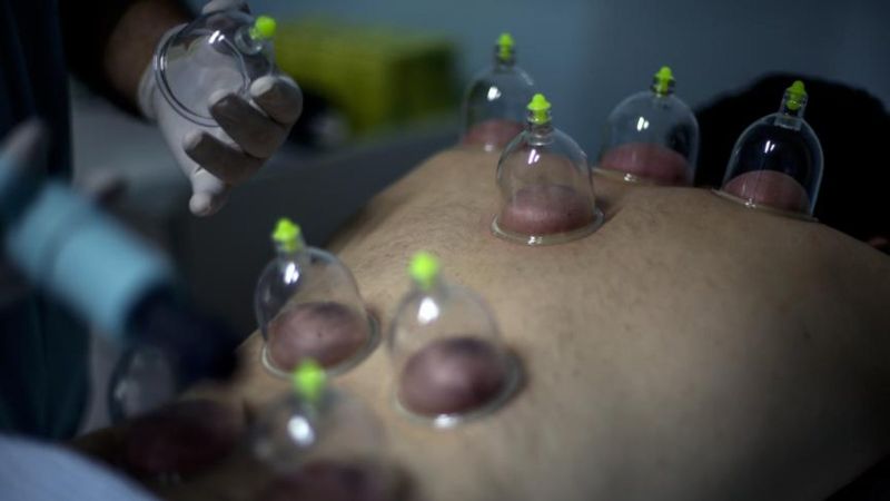 Hacamat günleri Nisan 2022: Ramazan'da hacamat yapılır mı, orucu bozar mı?