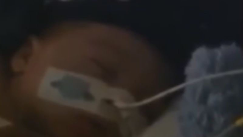 Faslı Yusuf bebek tedavi için Türkiye'ye getiriliyor