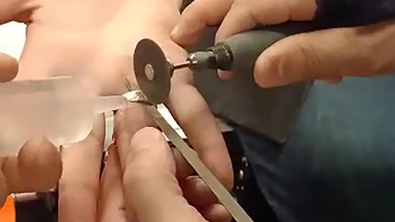 Erzurum'da acil servis, yüzüğü çıkmayan adam için seferber oldu