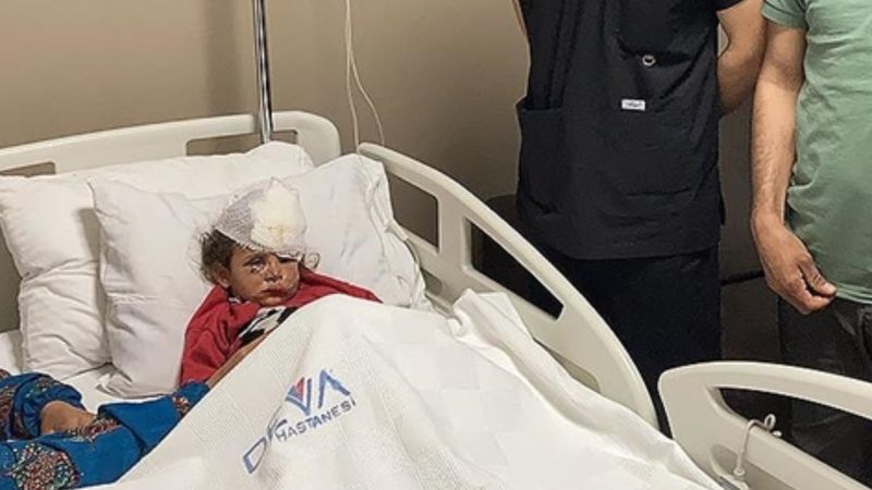 Şanlıurfa'da eşeğin ısırdığı çocuğun göz kapağı koptu