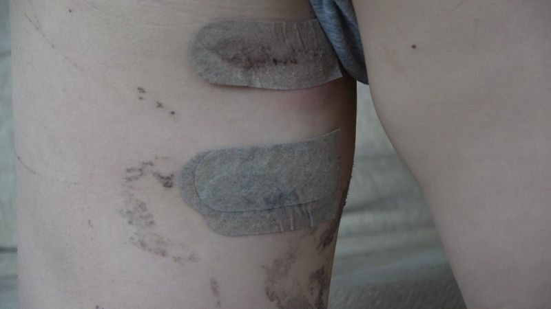 Denizli'de sokak köpekleri minik Tahir'e saldırdı