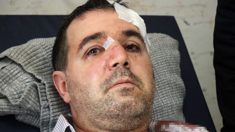 Sakarya'da taciz iddiası: Doktoru darbetti