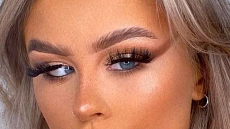 Göz rahatsızlığı genç kızı TikTok fenomeni yaptı