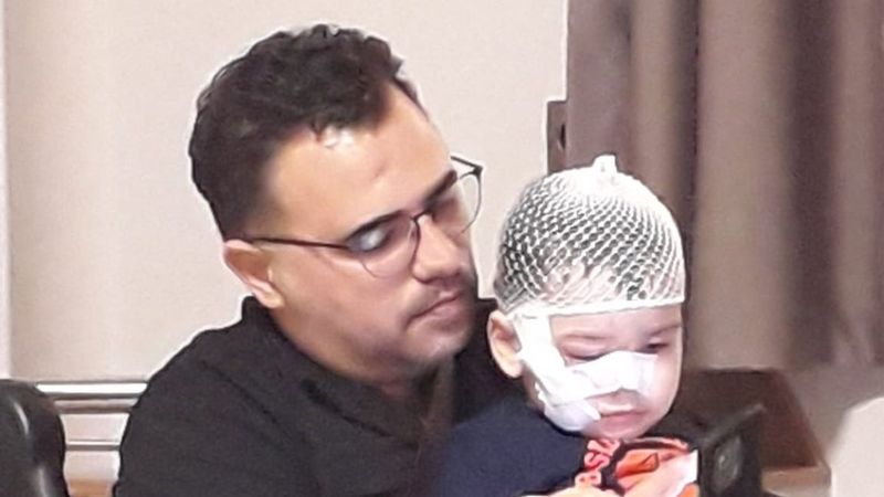 Adana'da güzellik yarışmasına katılan köpek, küçük çocuğun yüzünü parçaladı