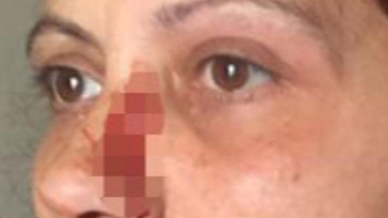 Büyükçekmece’deki kadın oturduğu sitede darbedildi