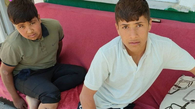 Iğdır'da oynarken köpek saldırısına uğrayan kuzenler kanlar içinde kaldı