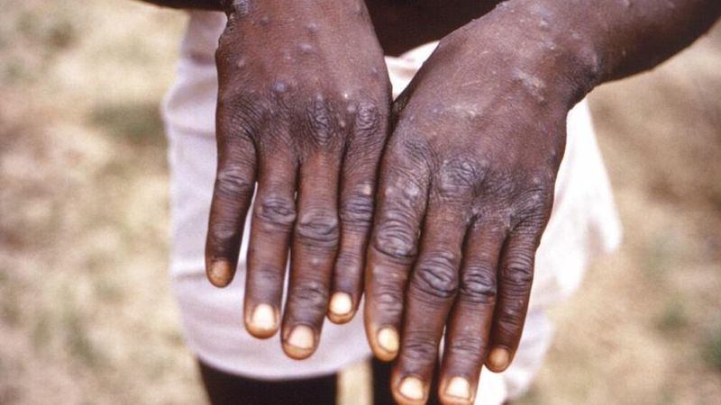 Uzmanlar 10 soruda açıkladı: Maymun çiçeği nedir, ne değildir