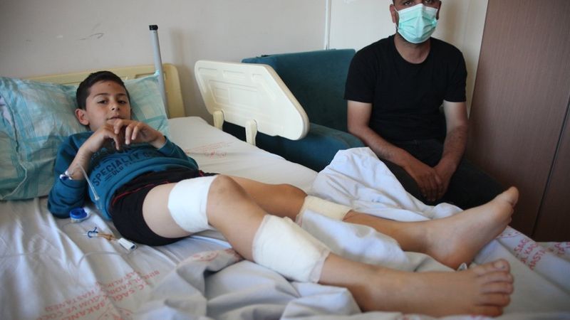 Bingöl'de 7 yaşındaki çocuk, bahçeye giren köpeklerin saldırısına uğradı