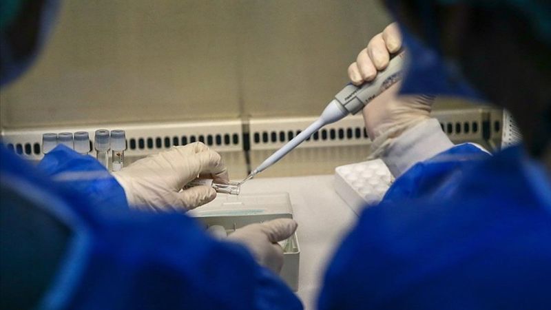 DSÖ'den maymun çiçeği açıklaması: Toplu aşılamaya ve sürü bağışıklığına gerek yok